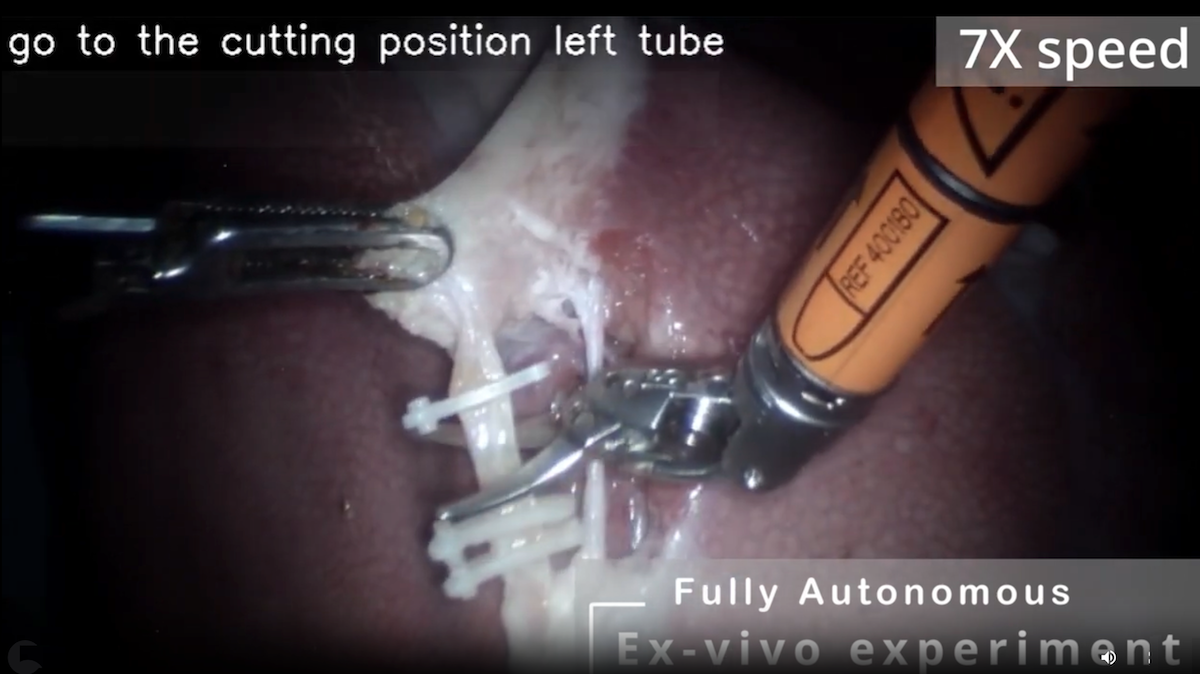 Open Agentic LLMs Proliferate, Robot Removes Gallbladders, Reasoning Models Boost Emissions, OpenAI Re-Opens
