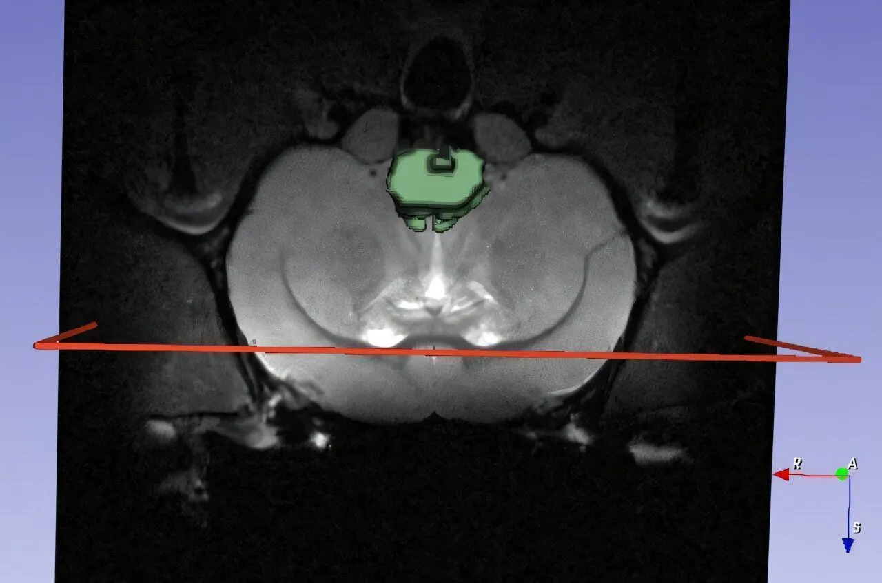 AI在纳米医学领域应用